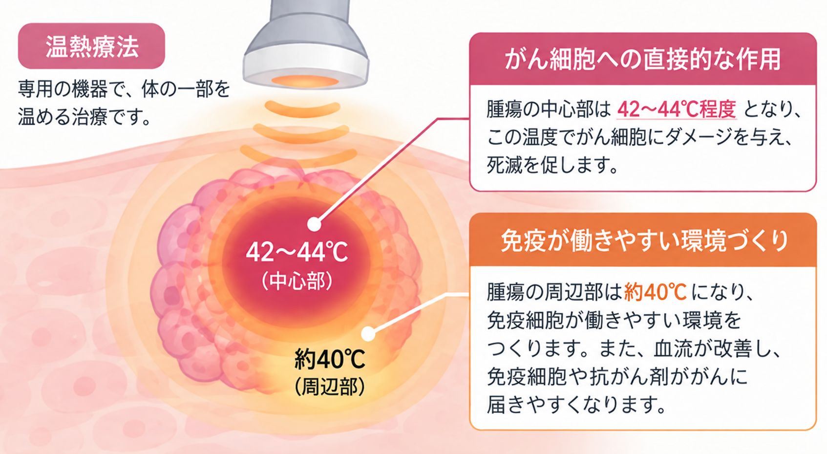 温熱療法によるがん細胞への直接的な作用と、免疫が働きやすい環境づくりを示す概念図